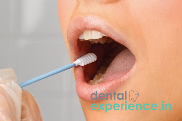 Salivary Testing