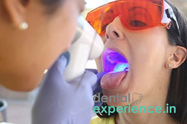 Oral Cancer Screening