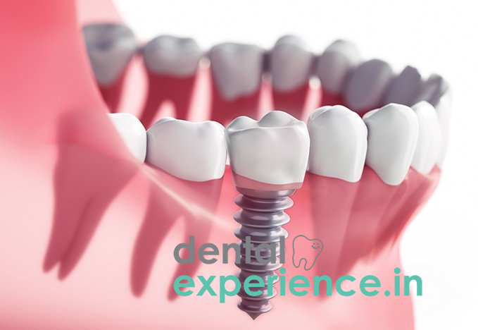 Need More Inspiration With dental center Dwarka sector 7? Read this!