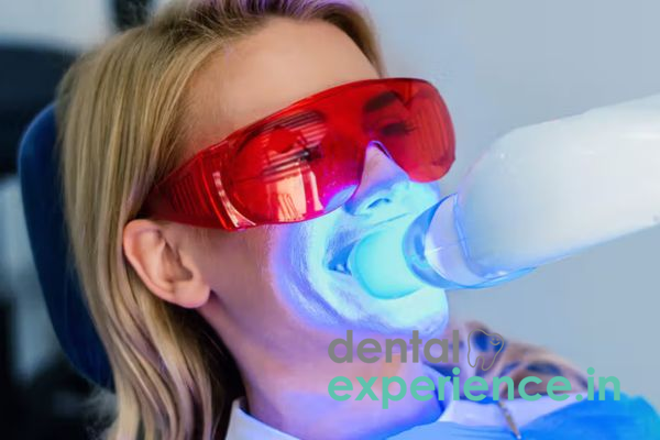 Zoom/ Laser Whitening