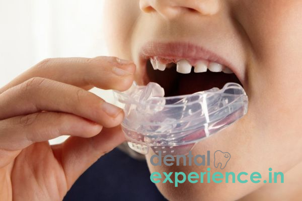 Sports Mouthguards