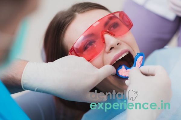 Fluoride Treatments